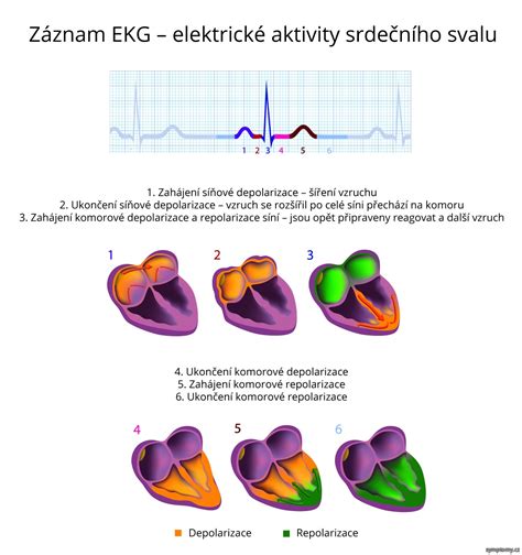 EKG záznam so zmenami