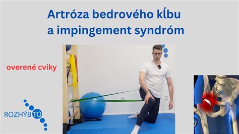 Rentgenový snímok bedrového kĺbu dieťaťa
