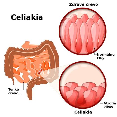 Schematické znázornenie gynekologického vyšetrenia